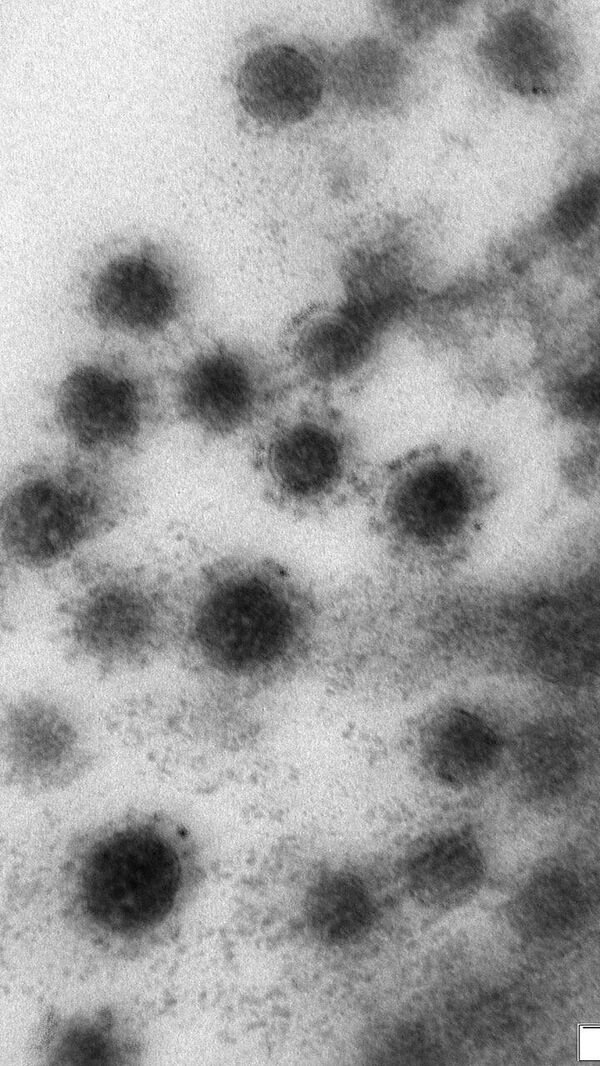 Фото дельта-штамма коронавируса, опубликованное научным центром Вектор