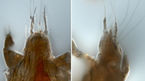 Ротовой аппарат расселительной стадии ископаемого клеща Levantoglyphus sidorchukae (вид сверху и сбоку).  У всех современных расселительной стадий развитый ротовой аппарат отсутствует