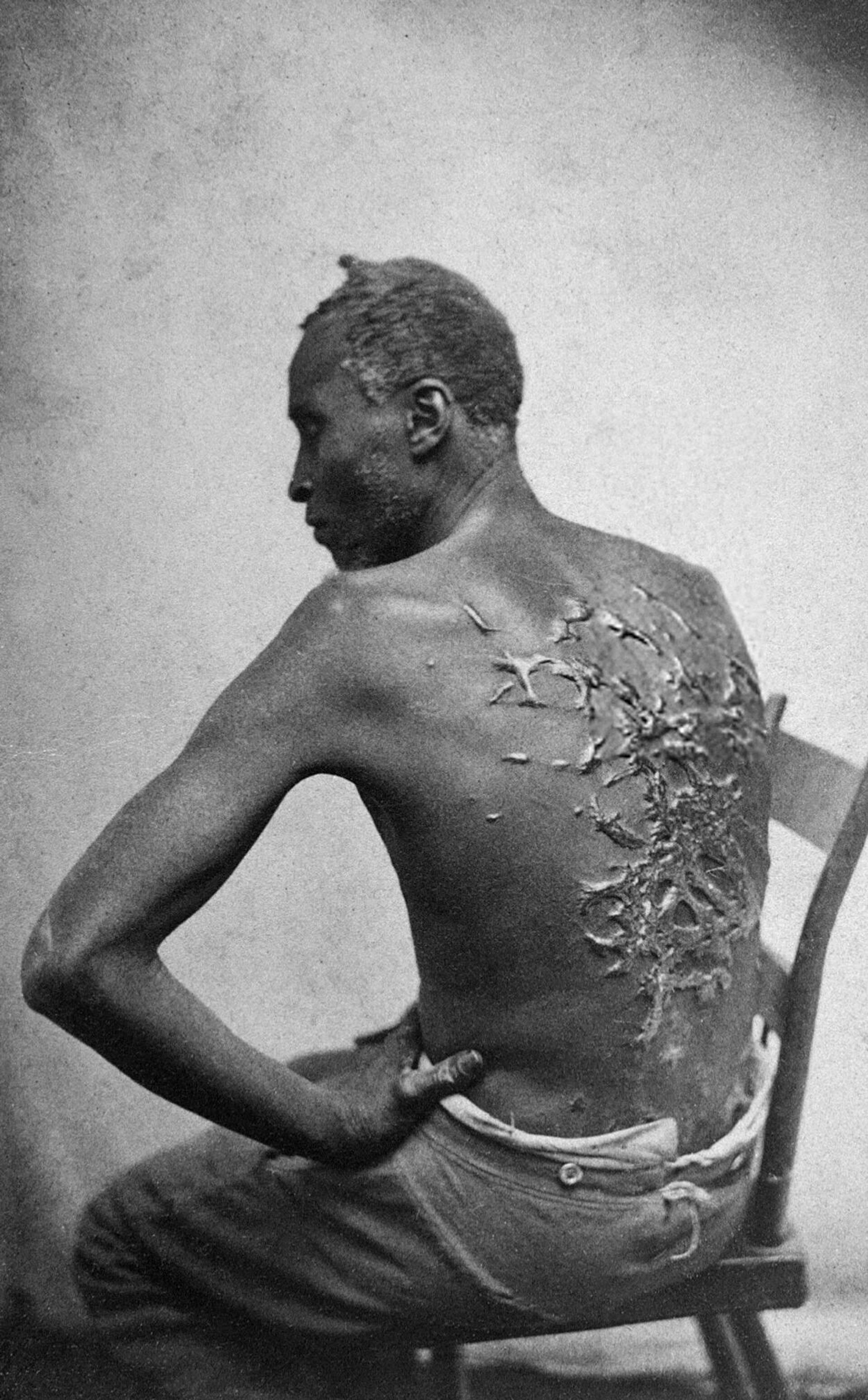 Американский раб с тяжелыми келоидными шрамами. 1863  - ПРОФИ Новости, 1920, 07.12.2021
