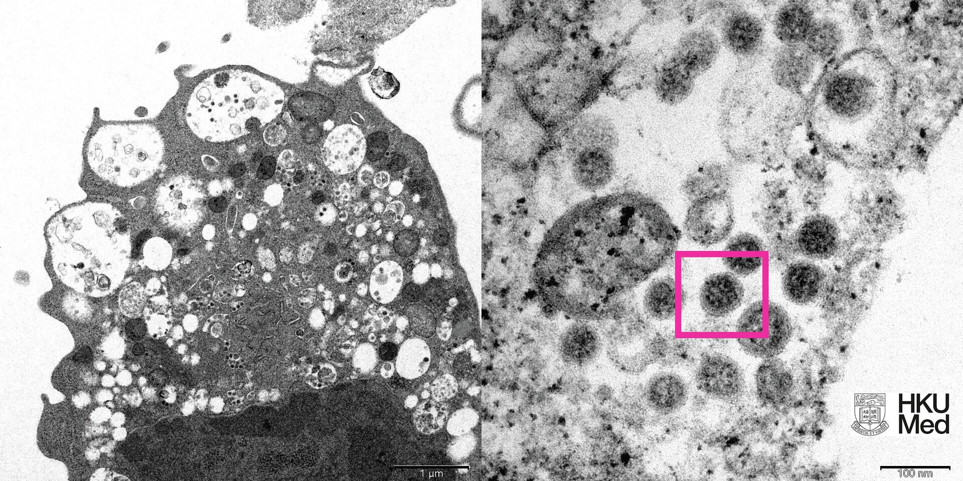 Электронная микрофотография почечной клетки обезьяны (Vero E6) после заражения вариантом вируса SARS-CoV-2 Omicron - ПРОФИ Новости, 1920, 08.12.2021