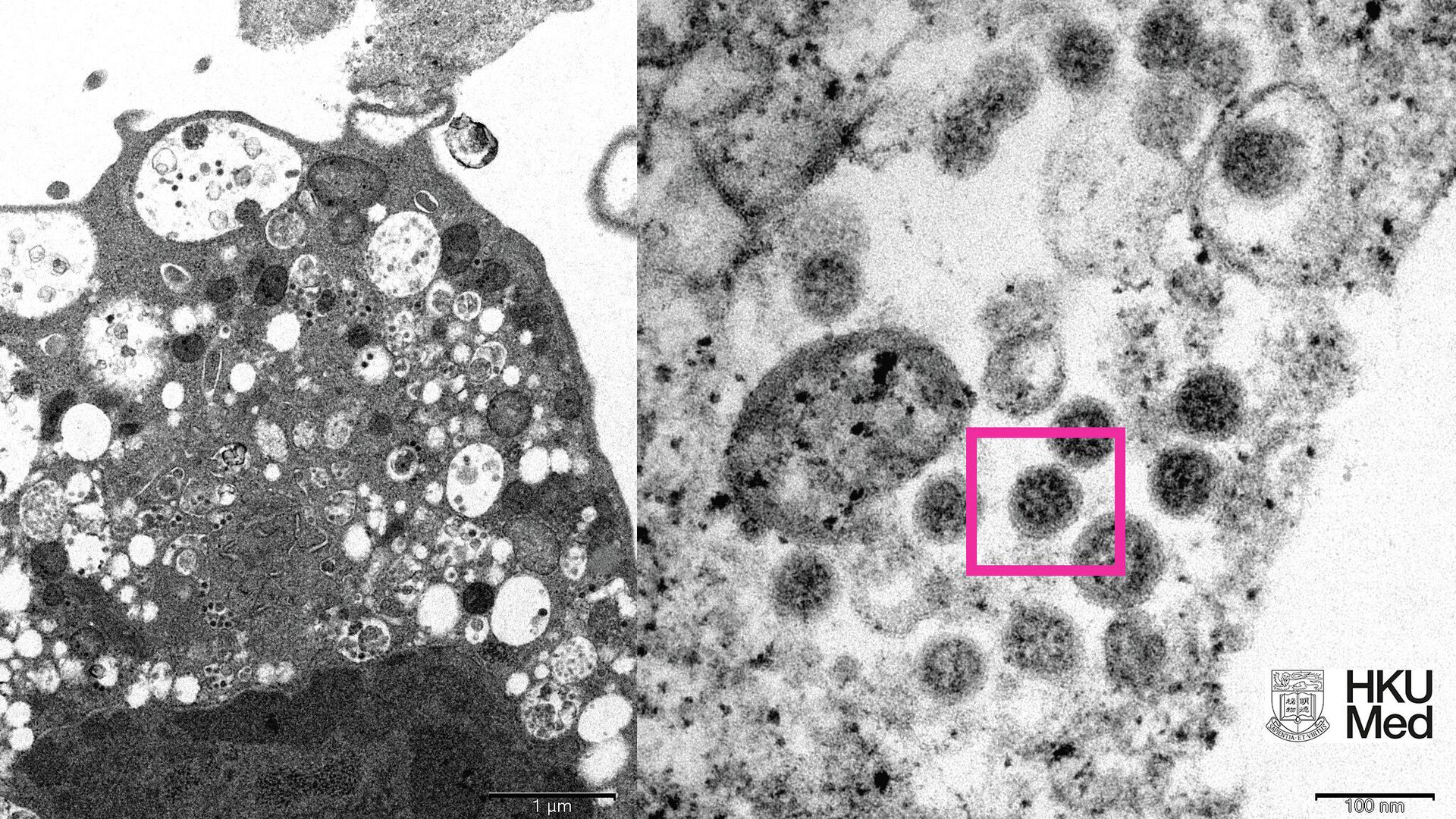 Электронная микрофотография почечной клетки обезьяны (Vero E6) после заражения вариантом вируса SARS-CoV-2 Omicron - РИА Новости, 1920, 08.12.2021