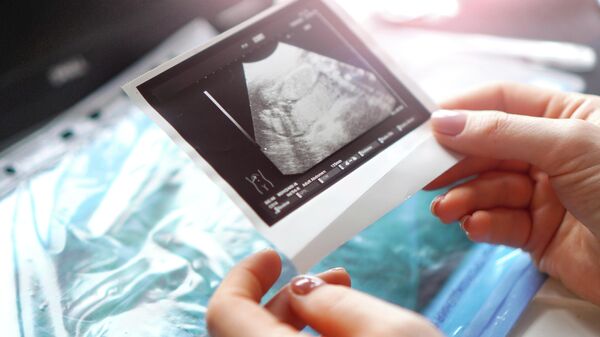 Беременная женщина держит в руках снимок УЗИ. Архивное фото