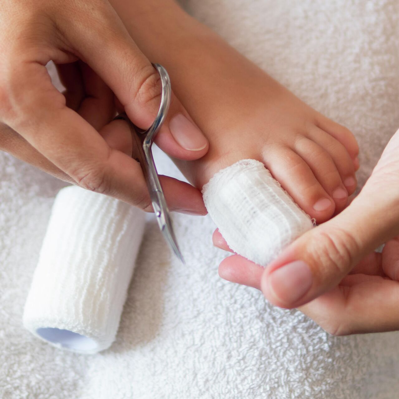 Трещины между пальцами ног – причины и лечение