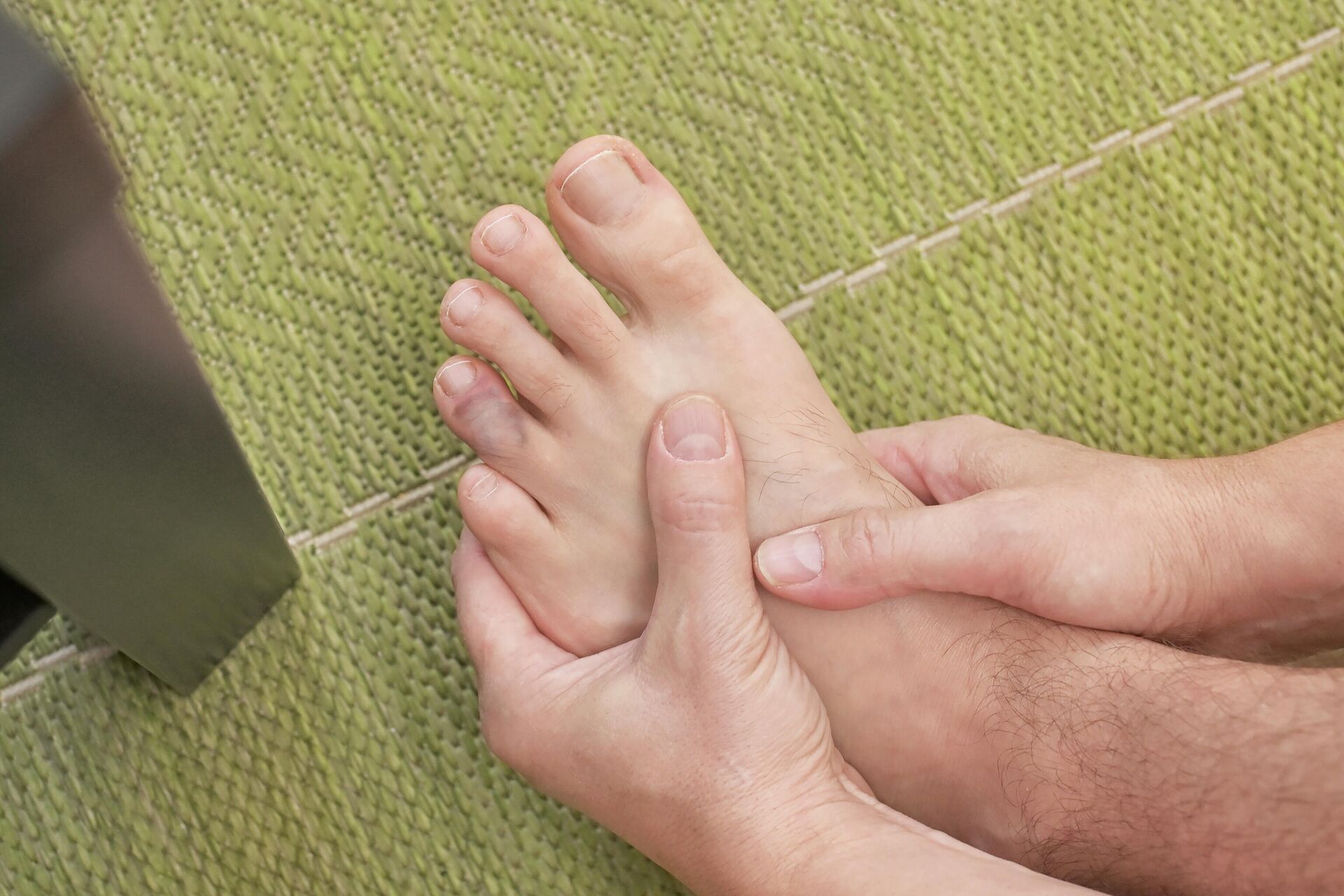 Ушиб пальца на ноге - причины, симптомы, лечение | что делать в домашних условиях