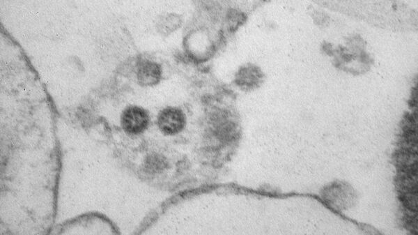 Фото вирусных частиц COVID-19 штамма омикрон