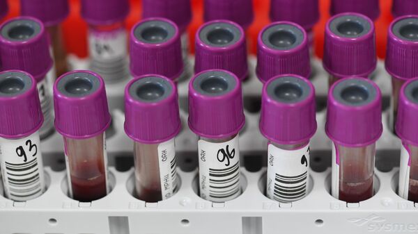 Пробирки с кровью пациентов в лаборатории по исследованию биохимического анализа крови