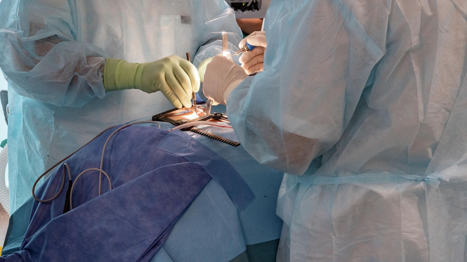 Хирурги во время операции в интегрированной эндоскопической 3D операционной - РИА Новости, 1920, 01.02.2022
