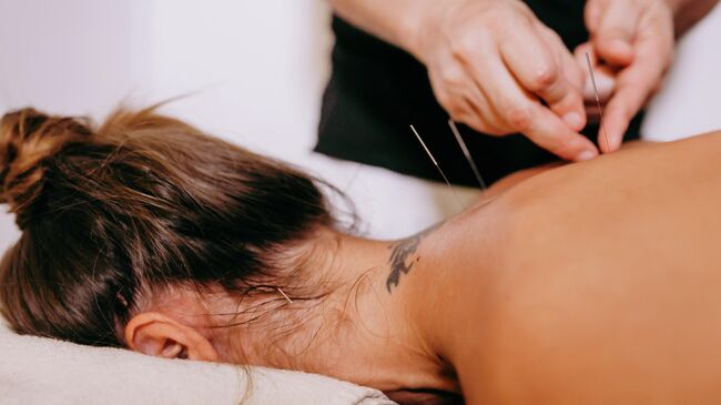 Иглорефлексотерапия