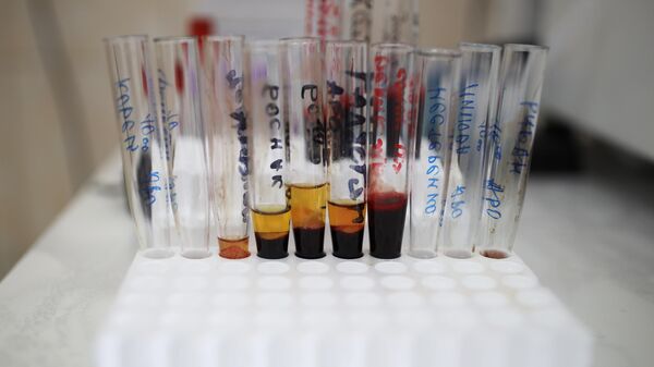 Пробирки с биологическим материалом в клинической лаборатории Красноармейской ЦРБ Краснодарского края