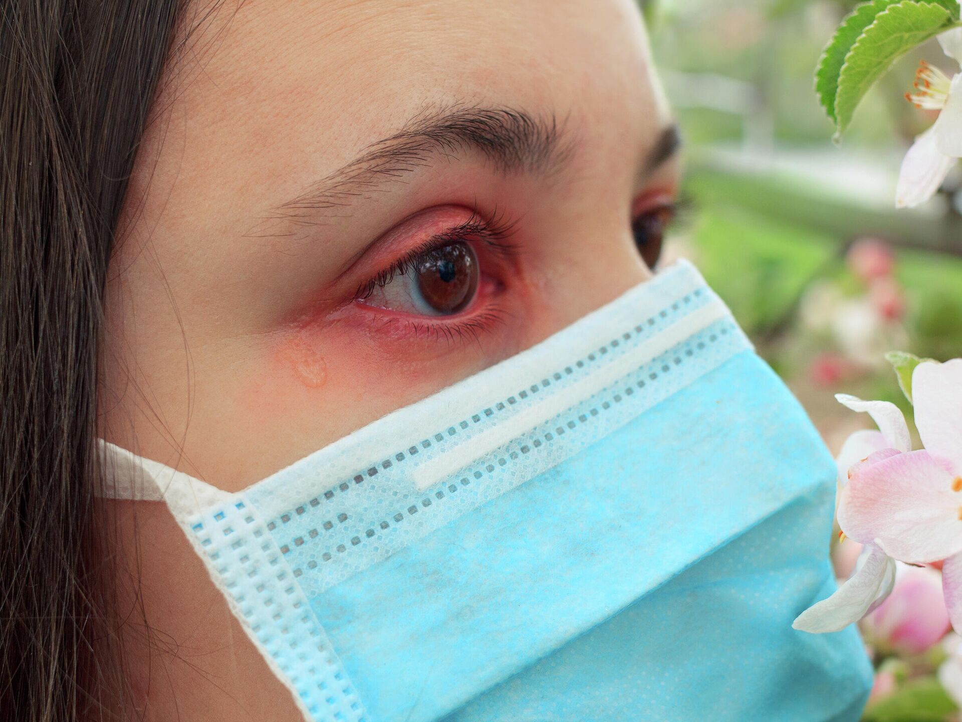 Почему глаза красные утром: причины и методы лечения