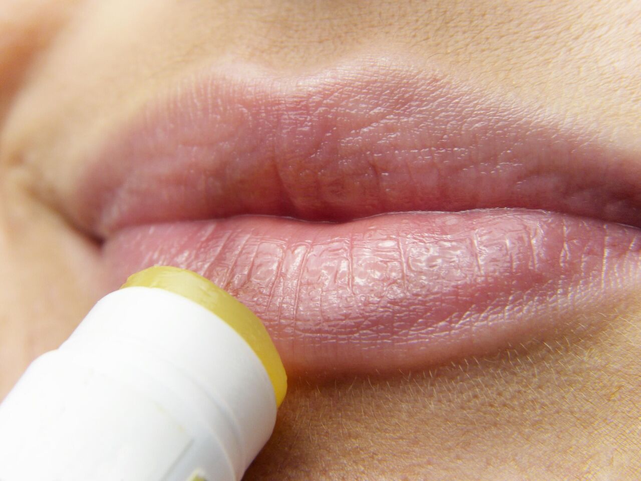Почему возникает герпес на губе и как его предотвратить