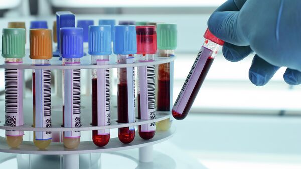 Пробирки с кровью в лабораторной центрифуге