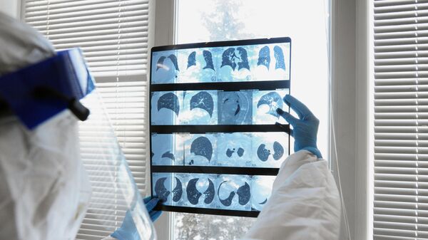 Медицинский работник изучает результат компьютерной томографии в инфекционном отделении для больных коронавирусом