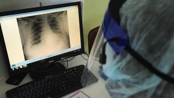 Медицинский работник изучает рентгеновский снимок органов грудной клетки. Архивное фото