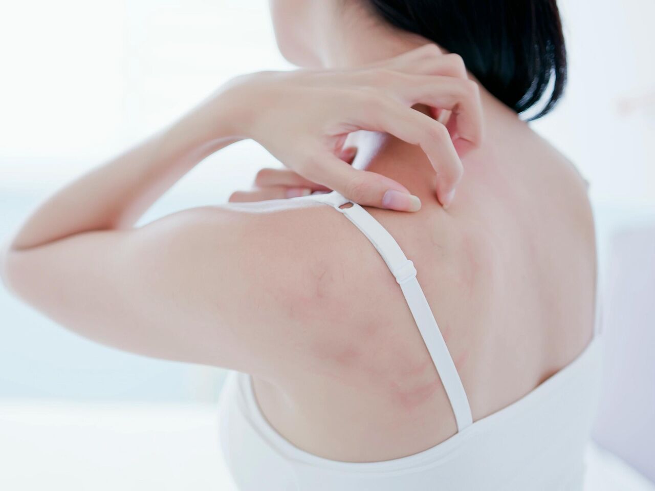 Лечение кожной сыпи в Кривом Роге – дерматолог, аллерголог