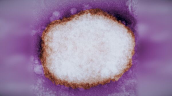Вирус оспы обезьян под электронным микроскопом