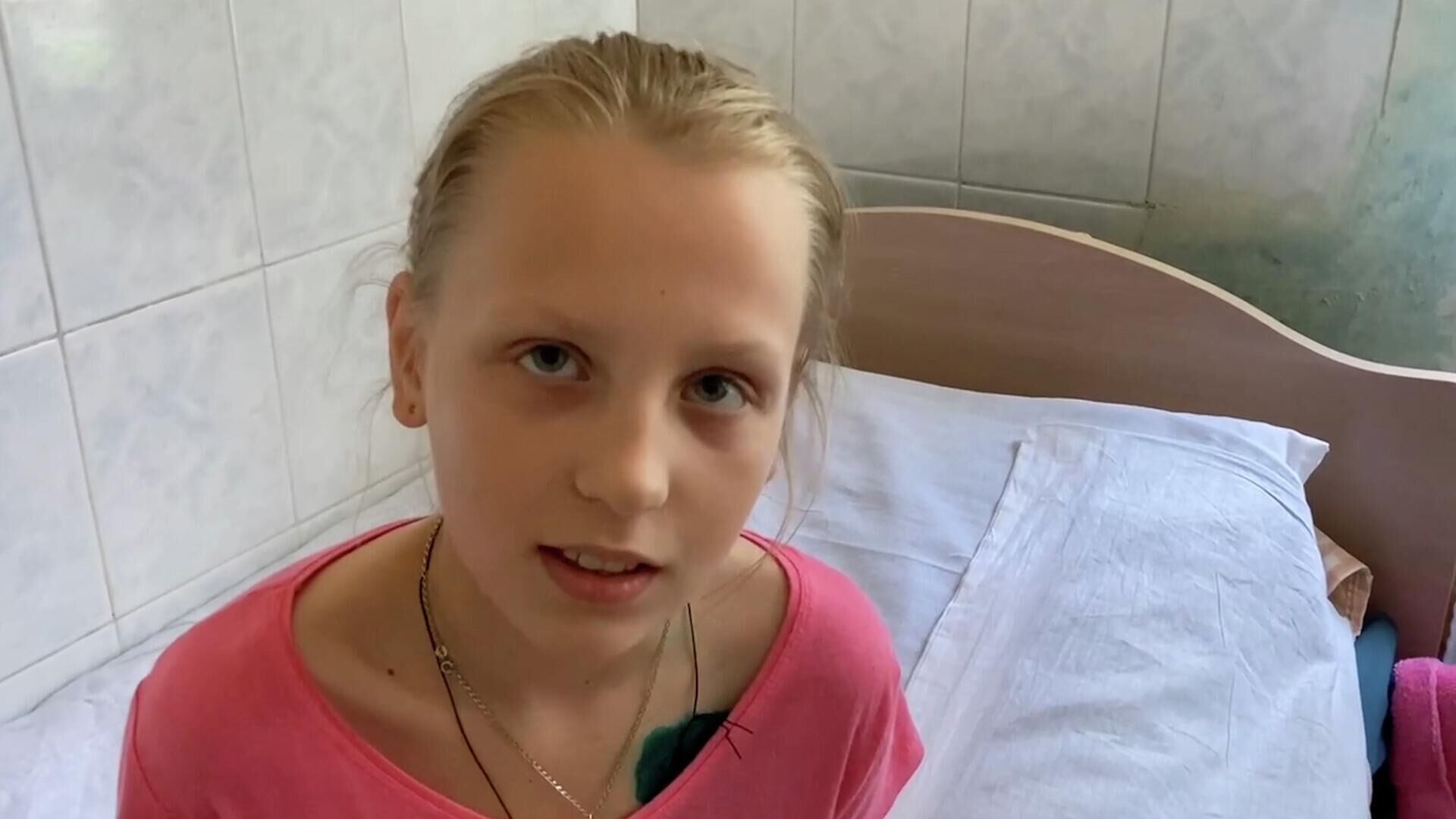 Осколок попал в легкое, минуя сердце: 11–летней Кате помогли врачи из Луганска - РИА Новости, 1920, 05.06.2022