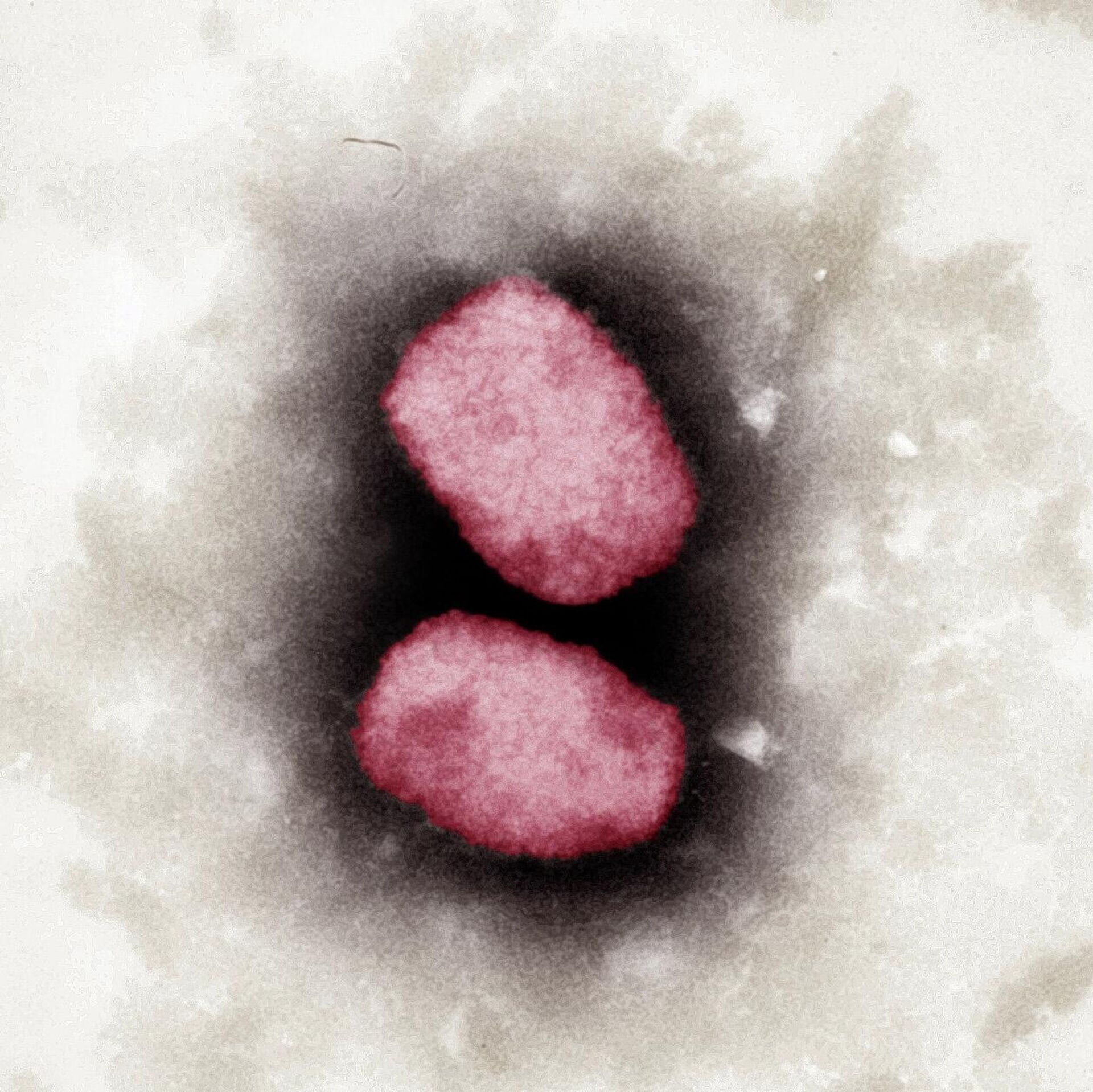 Снимок вируса оспы обезьян под микроскопом, 2001 год  - РИА Новости, 1920, 08.06.2022
