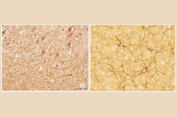 Слева: срез мозжечка с 40-кратным увеличением, полученный с помощью электронной микроскопии; справа: фрагмент космологического моделирования, одна сторона равна 300 миллионов световых лет