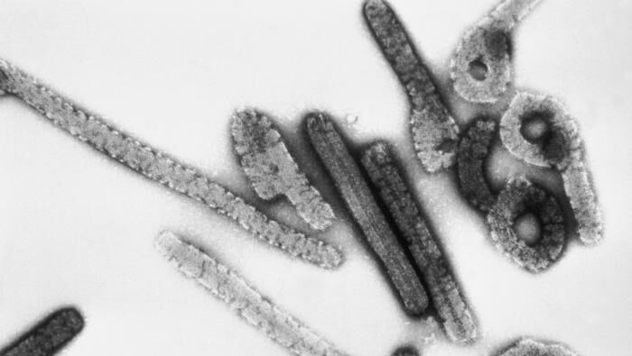Вирус Марбург под электронным микроскопом - РИА Новости, 1920, 02.10.2024