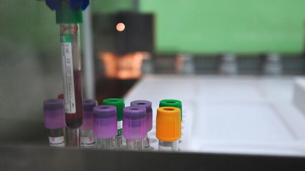 Исследование крови на ВИЧ-инфекцию в лаборатории Научного центра по профилактике и борьбе со СПИДом в Москве