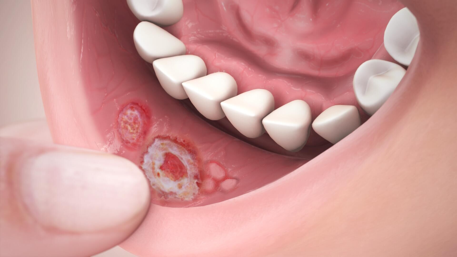 Разрыв суставной губы - лечение, симптомы, причины, диагностика | Центр Дикуля