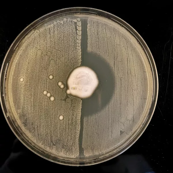 В центре лабораторной чашки с агар-агаром расположен грибок Trichophyton erinacei. В правой половине, где были чувствительные к метициллину бактерии Staphylococcus aureus, все микробы погибли. В левой, где расположены МРЗС, продолжается бактериальный рост