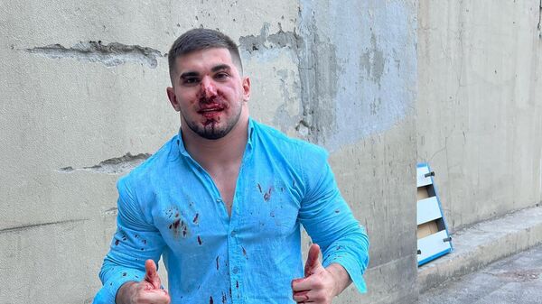 Блогер Асхаб Тамаев после избиения.