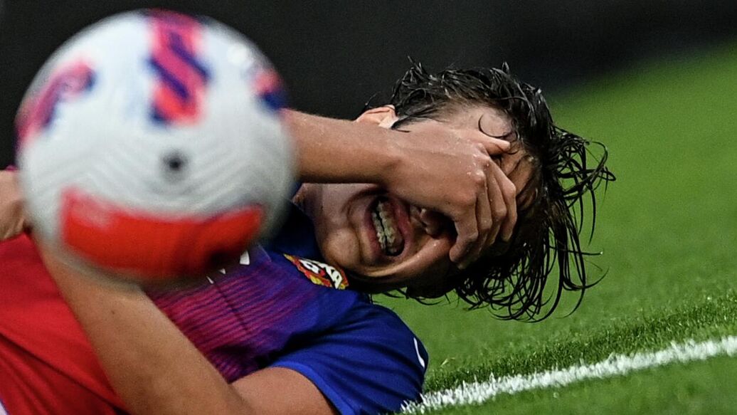 Футболисту ЦСКА зашили рану на голове после матча с "Зенитом"