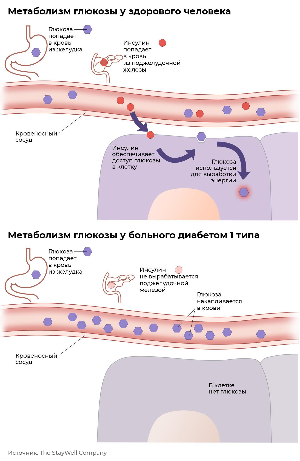 Метаболизм глюкозы у здорового человека и больного диабетом первого типа