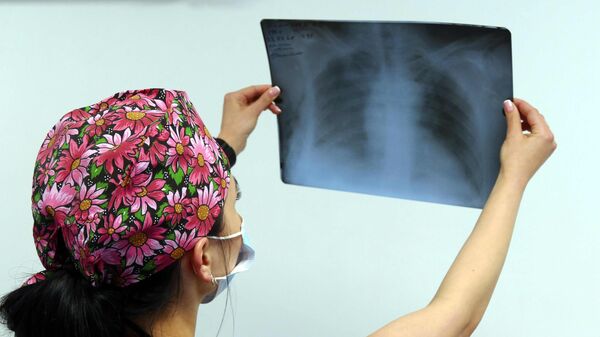 Медик смотрит рентгеновский снимок легких пациента