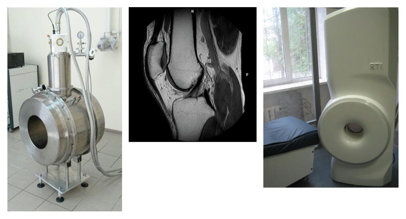 Прототип безгелиевого аппарата МРТ и полученный с его помощью снимок колена - РИА Новости, 1920, 26.10.2022