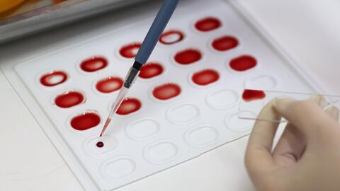 Экспресс-анализ по определению группы крови