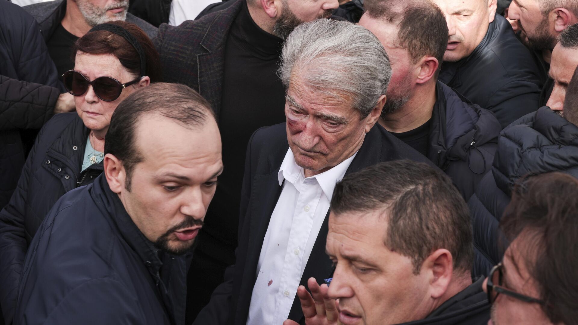 Сали Бериша, лидер албанской оппозиционной правоцентристской Демократической партии, после удара неизвестного мужчины во время акции протеста в Тиране - РИА Новости, 1920, 06.12.2022