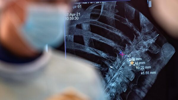 Монитор с изображение рентгеновского снимка позвоночника в операционной