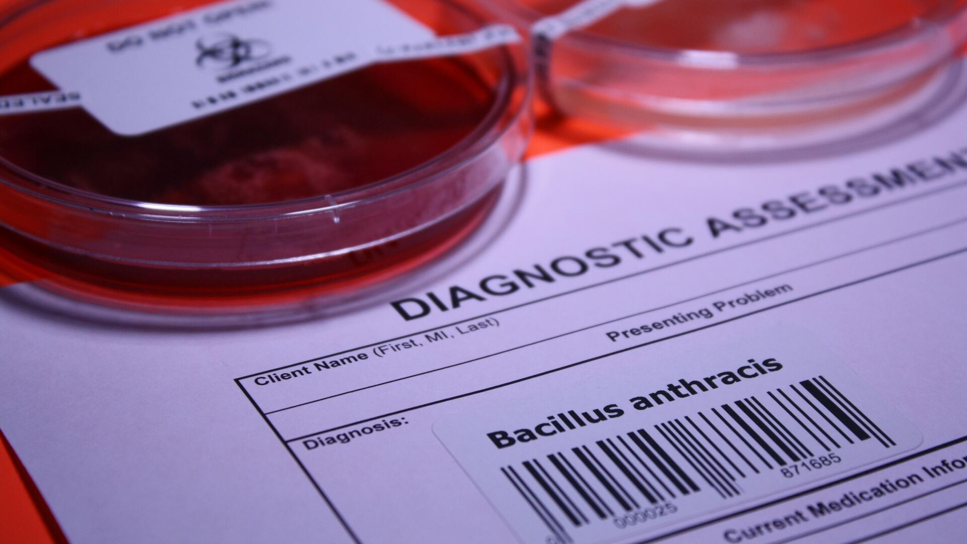 Палочка Bacillus anthracis  - РИА Новости, 1920, 24.03.2023