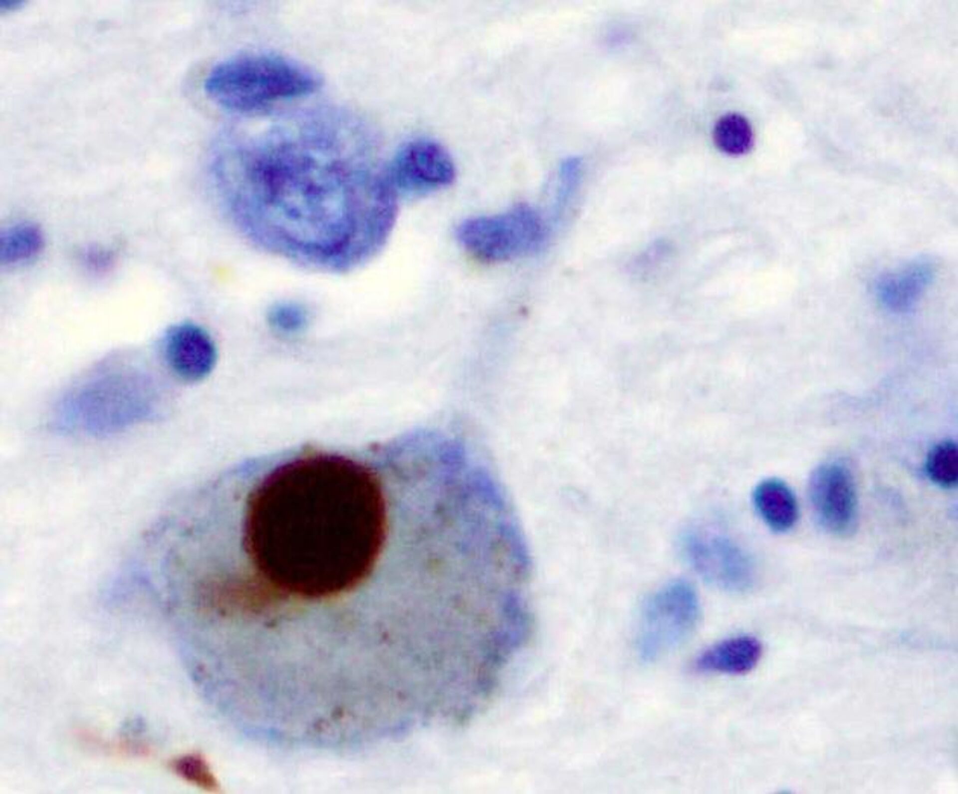 Тельце Леви (коричневое пятно) в нейроне черного вещества при болезни Паркинсона - РИА Новости, 1920, 31.03.2023