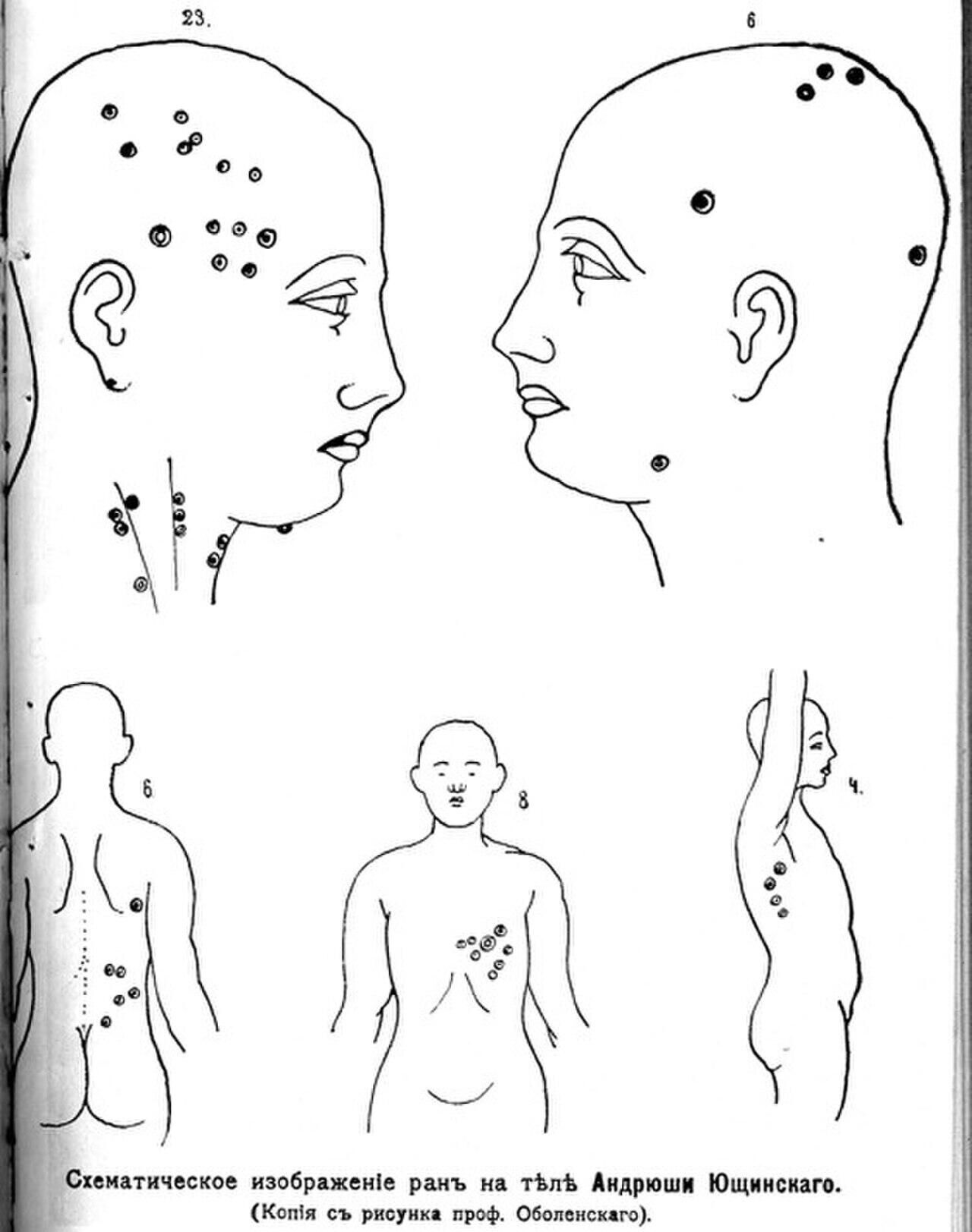 Схема расположения ран на теле Андрея Ющинского. Копия с рисунка профессора Оболонского - РИА Новости, 1920, 31.03.2023