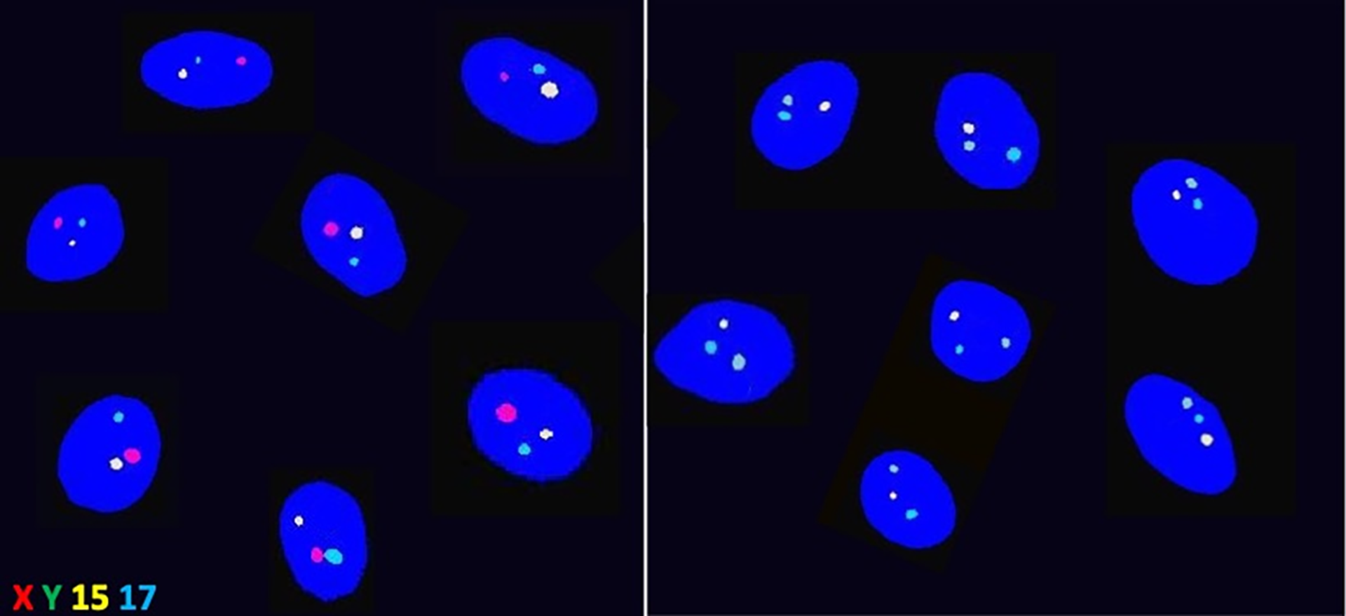 Метод флуоресцентной идентификации подтвердил эффективность отбора: слева сперматозоиды, несущие Х-хромосому, справа — Y-хромосому - РИА Новости, 1920, 31.03.2023