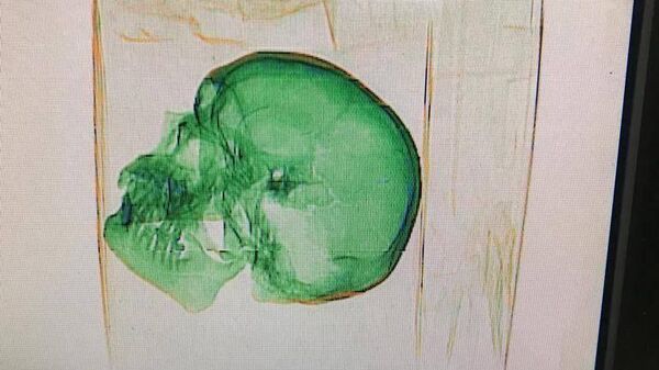 Человеческий череп в посылке в США, найденный в логистическом центре Внуково