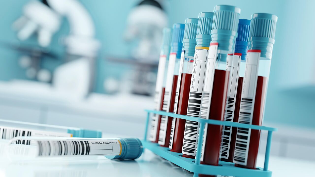 Анализ крови - Что надо знать, перед тем как сдавать кровь на анализы