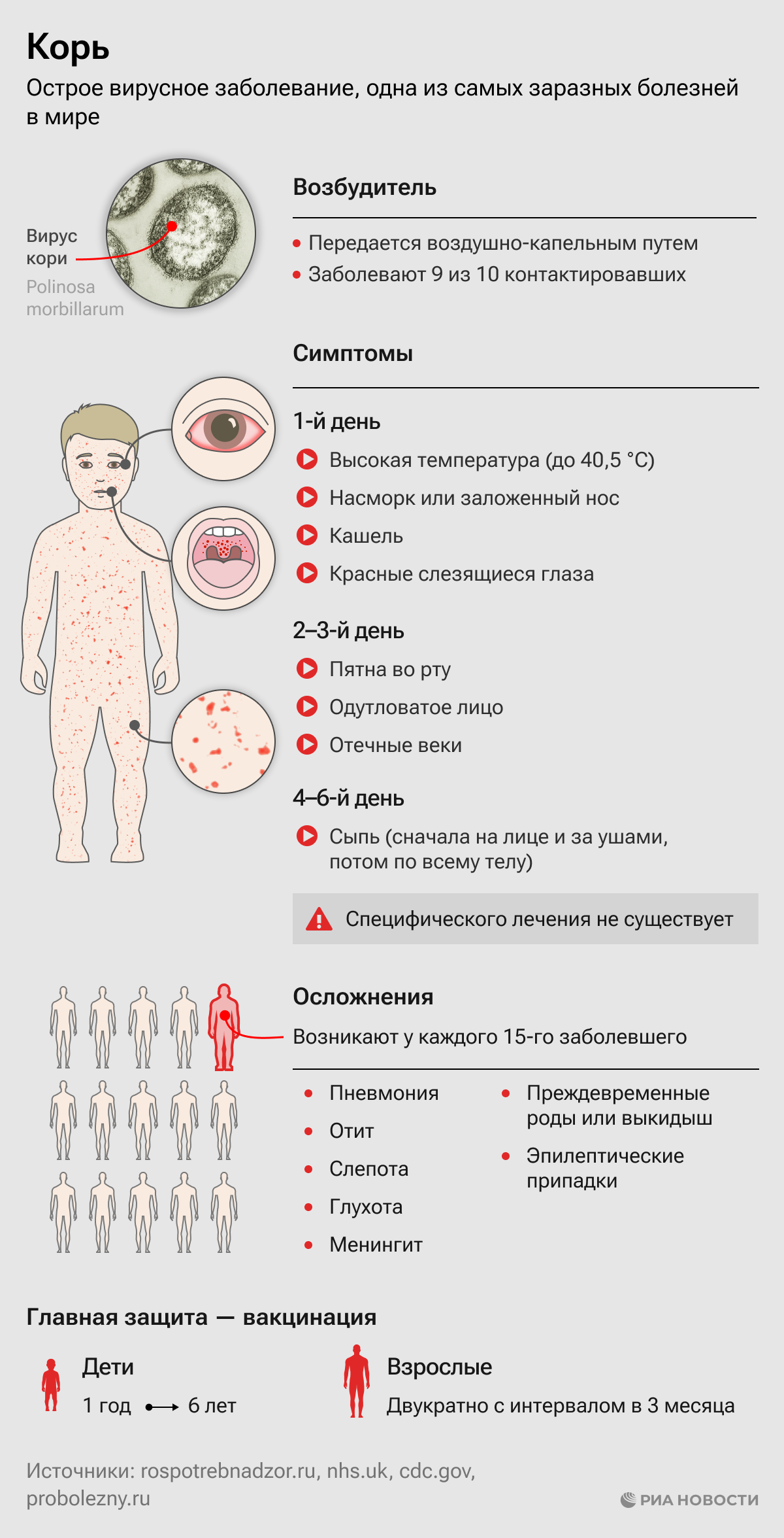 Симптомы кори в 2023 году