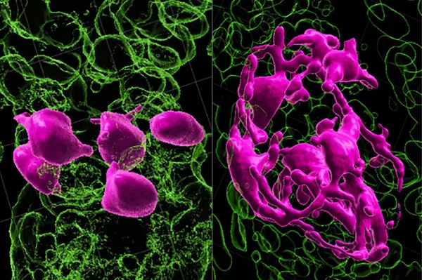Цветом выделены: слева — незрелые стволовые клетки меланоцитов; справа — активированные меланоциты в области дермального сосочка