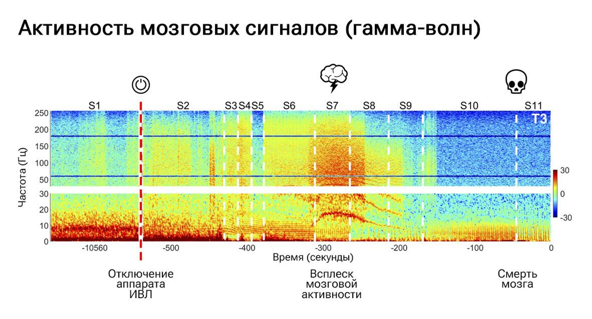 Активность мозговых сигналов (гамма-волн) - РИА Новости, 1920, 05.05.2023