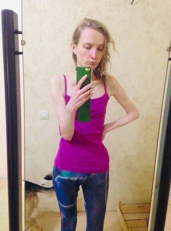 Алина Кустова после болезни Алина Кустова после болезни