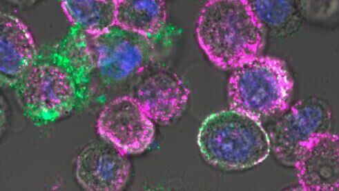 Онколитический вирус в раковых клетках - РИА Новости, 1920, 03.12.2025