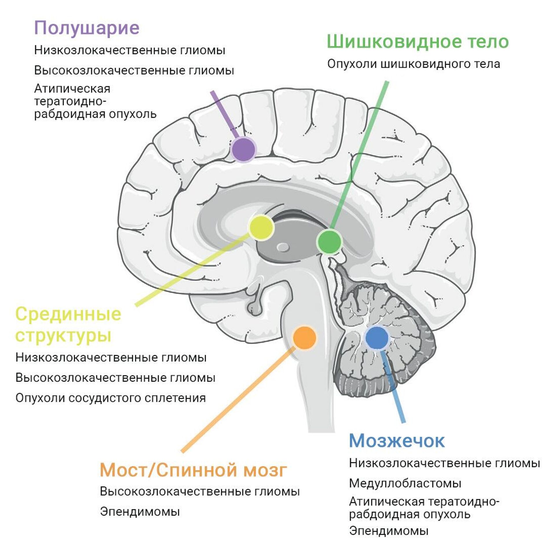 Ученые из России нашли средства борьбы с неизлечимыми опухолями мозга - РИА  Новости, 26.07.2023