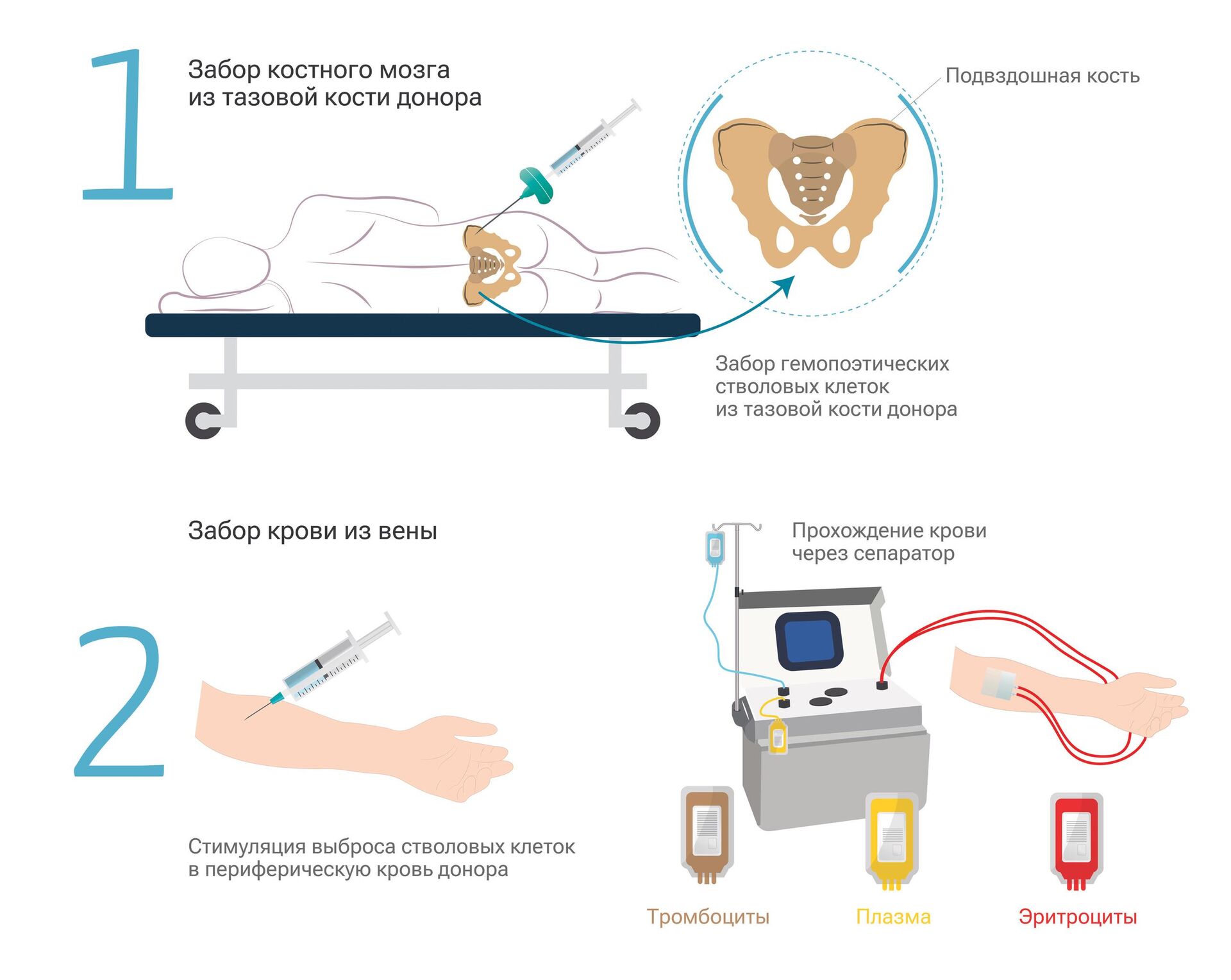 Два способа донорства костного мозга - РИА Новости, 1920, 15.09.2023