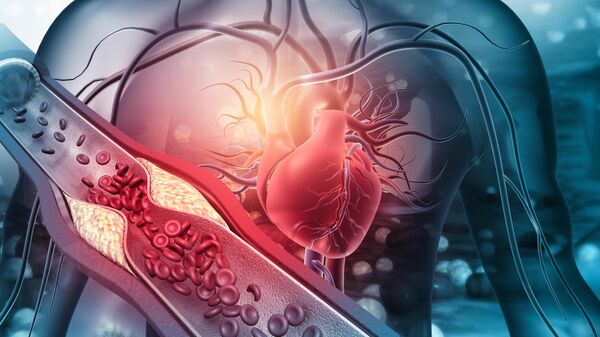 Человеческое сердце с закупоренными артериями