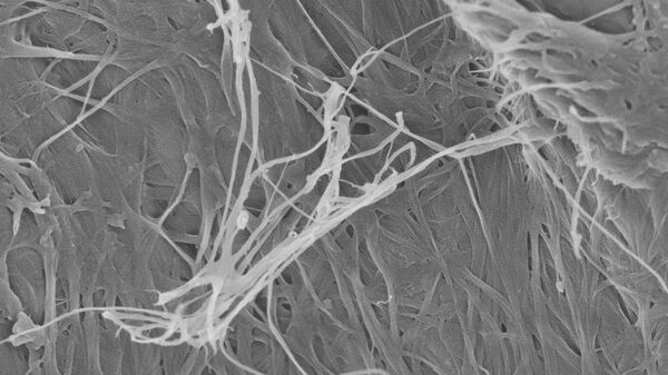 Сканирующая электронная микроскопия целлюлозных нановолокон